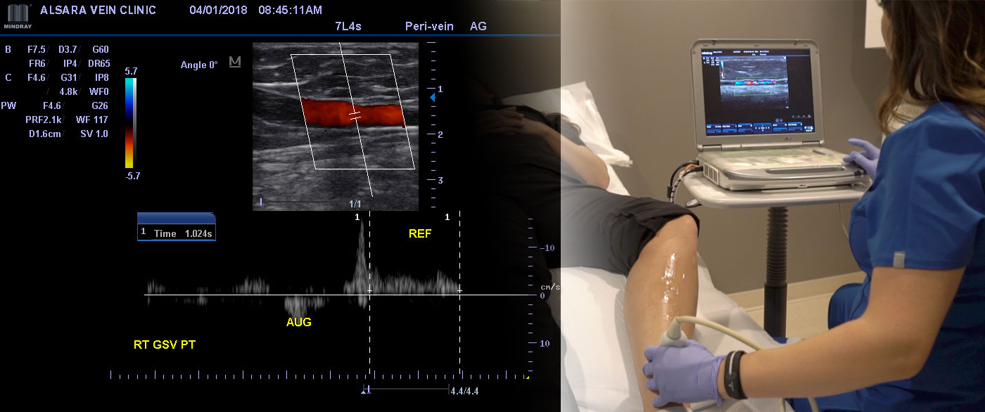 A Scan in Time Saves a Life