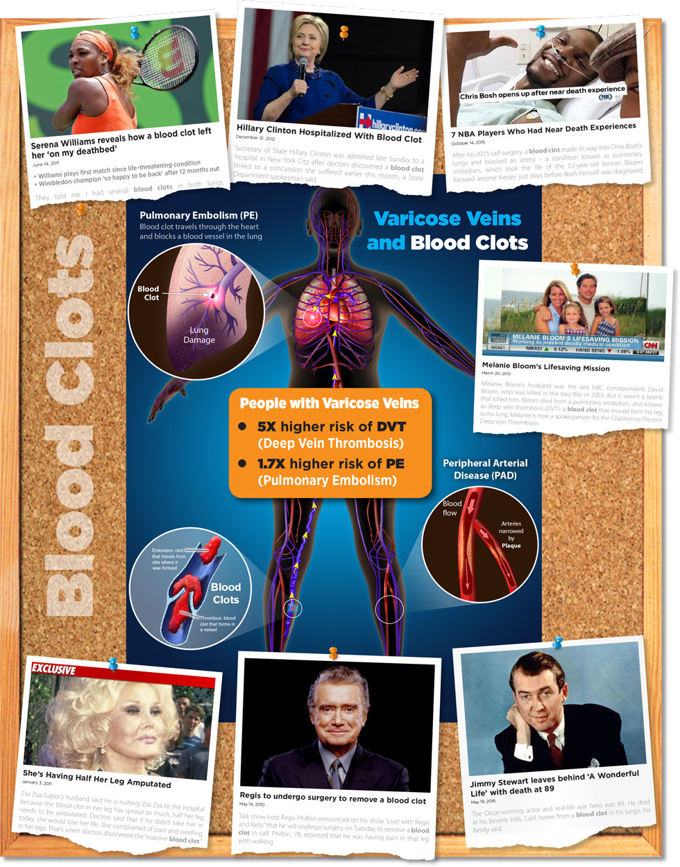 blood clots in the news