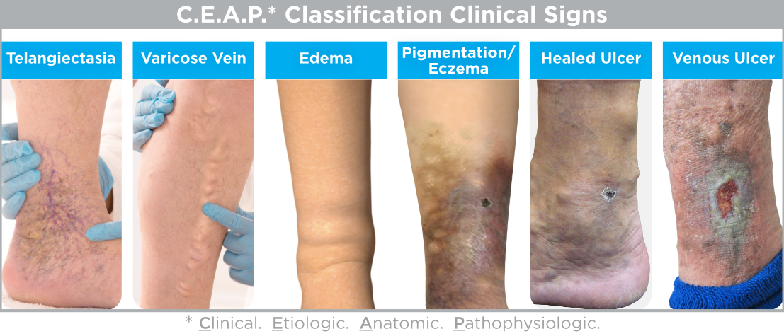 ceap classifications web