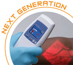 next generation spider vein treatments