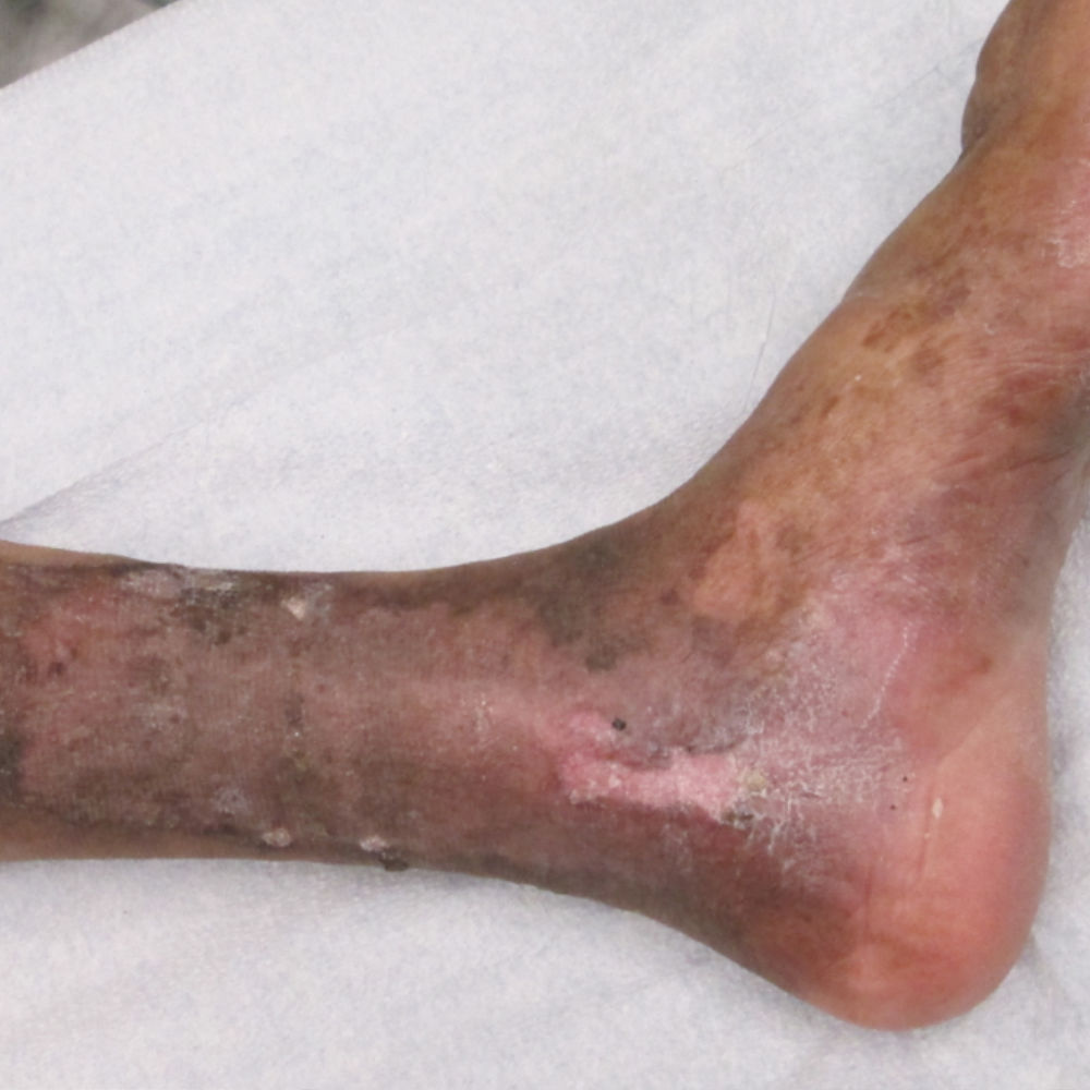 Patient 5