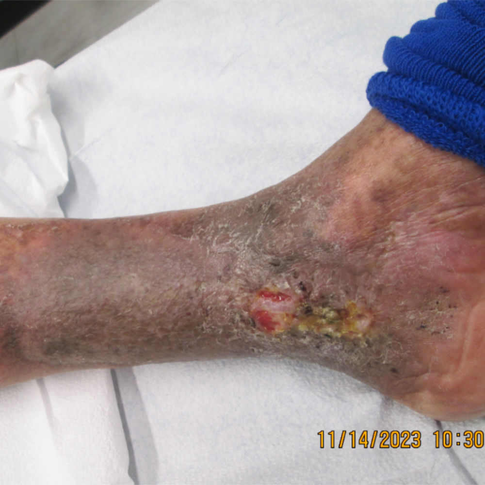 Patient 5