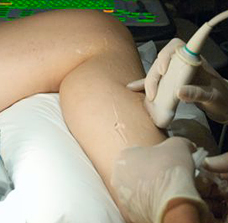 usgs mapping reveals if you have varicose veins