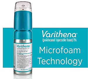 varithena microfoam treatment for varicose veins